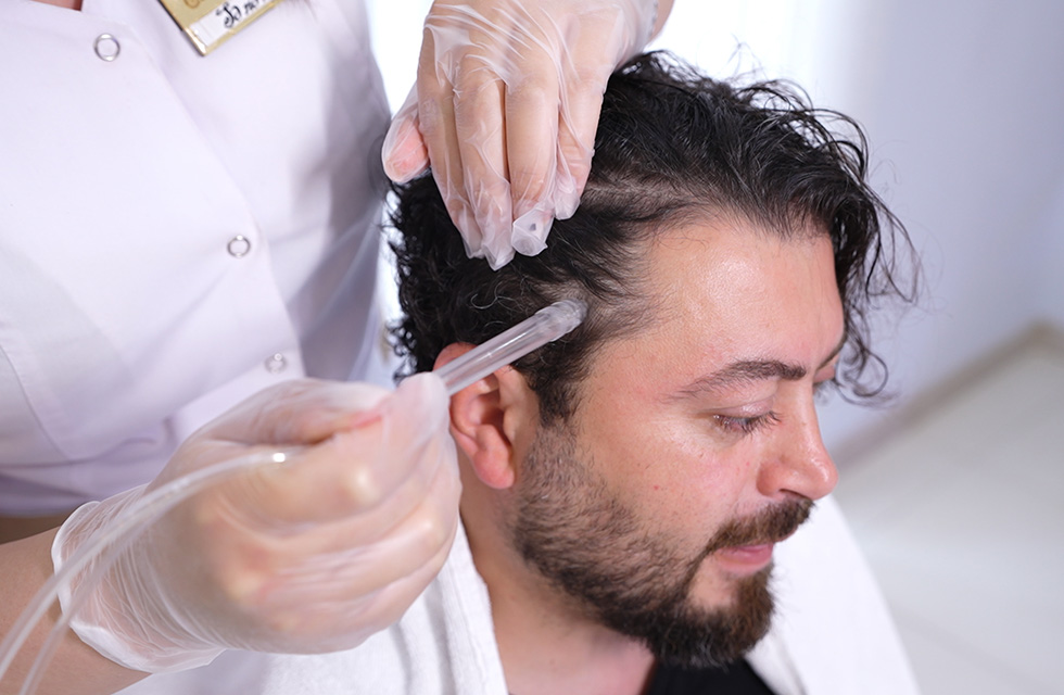 TREATMENT OF SEBORRHEA