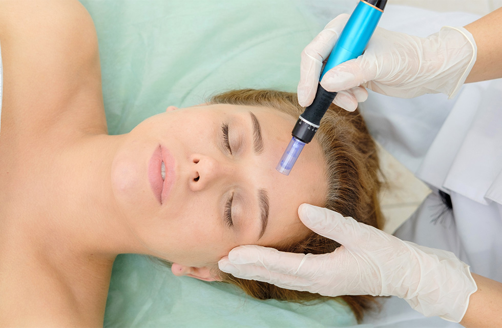 Microneedling